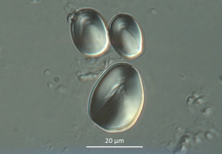 Transmitted light microscope image of starch grains.
