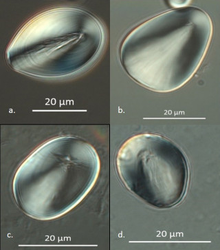 In the Tiny World of Starch Grains, Bigger is Better | Natural History ...